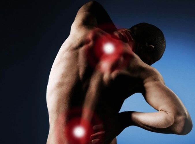 bolečine v hrbtu zaradi osteohondroze hrbtenice