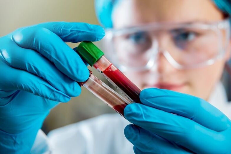 Popoln krvni test za diagnosticiranje bolečine v križu